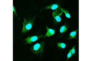 IF analysis of CARD9 using anti-CARD9 antibody (ABIN7599386). (CARD9 antibody  (AA 1-429))