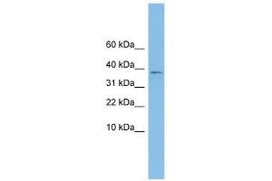 KLHDC9 antibody used at 1 ug/ml to detect target protein. (KLHDC9 antibody  (Middle Region))