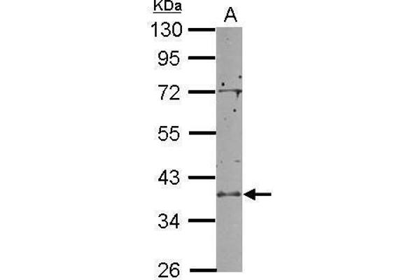 RCL1 antibody