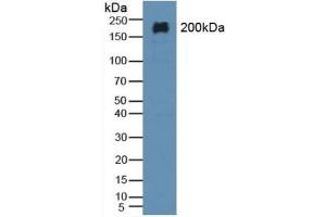 Detection of MAP2 in Rat Brain Tissue using Polyclonal Antibody to Microtubule Associated Protein 2 (MAP2) (MAP2 antibody  (AA 727-985))