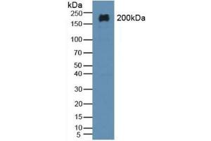 Detection of MAP2 in Rat Brain Tissue using Polyclonal Antibody to Microtubule Associated Protein 2 (MAP2) (MAP2 antibody  (AA 727-985))