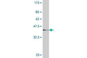 Western Blot detection against Immunogen (37 KDa) . (PCNA antibody  (AA 78-177))