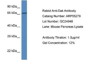 Western Blotting (WB) image for anti-Dihydroxyacetone Kinase 2 Homolog (DAK) (N-Term) antibody (ABIN2786123) (DAK antibody  (N-Term))