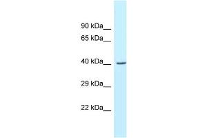 WB Suggested Anti-Gcat Antibody   Titration: 1. (GCAT antibody  (C-Term))
