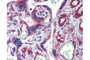 Immunohistochemistry (IHC) image for anti-Multiple C2 Domains, Transmembrane 1 (MCTP1) (Middle Region) antibody (ABIN2781866) (MCTP1 antibody  (Middle Region))