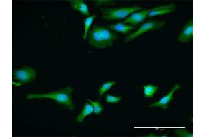 Immunofluorescence of purified MaxPab antibody to PABPC1 on HeLa cell. (PABP antibody  (AA 1-636))