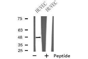 Western blot analysis of extracts from HUVEC cells using GPRC5B antibody.
