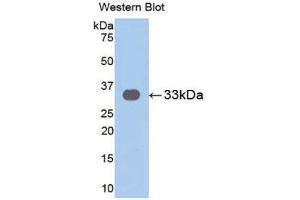 Western Blotting (WB) image for anti-Interleukin 31 Receptor A (IL31RA) (AA 205-456) antibody (ABIN1859419) (IL31RA antibody  (AA 205-456))