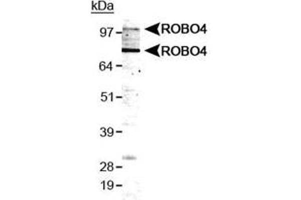 ROBO4 antibody  (AA 200-300)