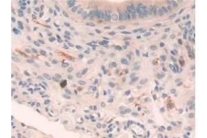 Immunohistochemistry (IHC) image for anti-Legumain (LGMN) (AA 18-435) antibody (ABIN7440881)