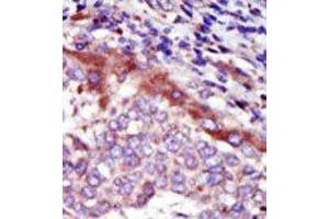 Image no. 2 for anti-Hormonally Up-Regulated Neu-Associated Kinase (HUNK) (C-Term) antibody (ABIN360358) (HUNK antibody  (C-Term))