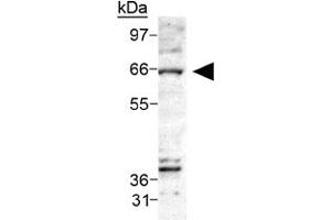 Western blot analysis of CERK on Ceramide Kinase in A-549 cell lysate using CERK polyclonal antibody .