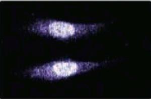 Immunofluorescence staining of human endothelial cells. (MAD2L2 antibody  (AA 81-180))