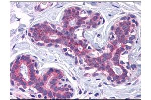 Human Breast: Formalin-Fixed, Paraffin-Embedded (FFPE) (SCAMP4 antibody  (C-Term))