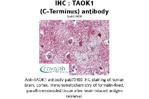 Image no. 1 for anti-TAO Kinase 1 (TAOK1) (C-Term) antibody (ABIN1739898) (TAO Kinase 1 (TAOK1) (C-Term) antibody)