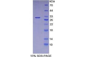 SDS-PAGE analysis of Human CAD Protein.
