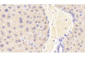 Detection of CORT in Mouse Liver Tissue using Polyclonal Antibody to Carnitine-O-Octanoyltransferase (CORT) (CROT antibody  (AA 410-612))