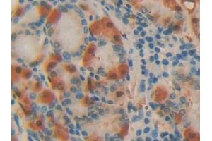 DAB staining on IHC-P; Samples: Human Stomach Tissue (ADA antibody  (AA 11-280))