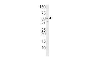 Western blot analysis of anti-HH3R Pab (Rabbit ID 1071) in Jurkat cell line lysate (35 μg/lane). (HRH3 antibody  (C-Term))