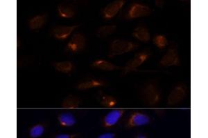 Immunofluorescence analysis of U-2 OS cells using SCD Polyclonal Antibody at dilution of 1:100 (40x lens).