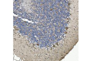 IHC analysis of non-muscle Myosin IIB/MYH10 using anti-non-muscle Myosin IIB/MYH10 antibody (ABIN7603186).