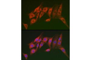 Immunofluorescence analysis of NIH/3T3 cells using MTMR14 Rabbit pAb (ABIN6129695, ABIN6144154, ABIN6144155 and ABIN6223372) at dilution of 1:100 (40x lens). (MTMR14 antibody  (AA 1-280))