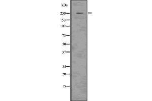 Western blot analysis Aggrecan using 293 whole cell lysates. (Aggrecan antibody)