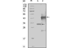 Western blot analysis using EphA4 mouse mAb against truncated Trx-EphA4 recombinant protein (1) and truncated GST-EphA4(aa777-986) recombinant protein (2). (EPH Receptor A4 antibody  (AA 777-986))