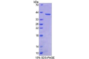 SDS-PAGE (SDS) image for Bone Morphogenetic Protein 3 (BMP3) (AA 373-472) protein (His tag,GST tag) (ABIN6236832) (BMP3 Protein (AA 373-472) (His tag,GST tag))