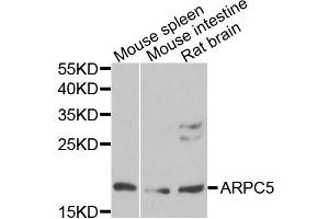 Western blot analysis of extracts of various cell lines, using ARPC5 antibody. (ARPC5 antibody)