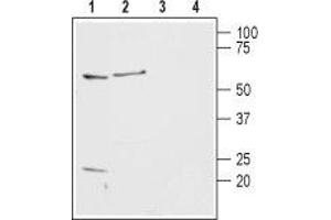 Western blot analysis of rat basophilic leukemia cells (RBL) (lanes 1 and 3) and rat brain lysates (lanes 2 and 4): - 1,2. (HRH2 antibody  (2nd Extracellular Loop))