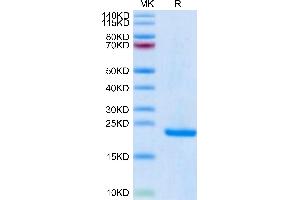 Midkine Protein (AA 21-143) (His-Avi Tag)