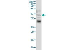 LASS4 monoclonal antibody (M03), clone 7D5 Western Blot analysis of LASS4 expression in HeLa . (LASS4 antibody  (AA 57-139))