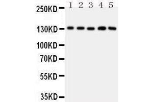 Anti-Thrombospondin 2 antibody, Western blotting All lanes: Anti THBS2  at 0. (Thrombospondin 2 antibody  (Middle Region))