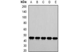 Western blot analysis of PSMC4 expression in HepG2 (A), A549 (B), Hela (C), Jurkat (D), mouse liver (E) whole cell lysates. (PSMC4 antibody)