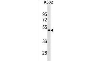 Western Blotting (WB) image for anti-G Protein-Coupled Receptor 39 (GPR39) antibody (ABIN3000707) (GPR39 antibody)