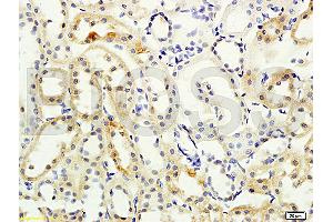 Formalin-fixed and paraffin embedded rat kidney labeled with Anti- NCX2/SLC8A2 Polyclonal Antibody, Unconjugated (ABIN676478) at 1:200 followed by conjugation to the secondary antibody and DAB staining (SLC8A2 antibody  (AA 601-700))