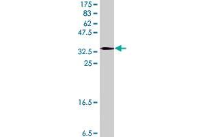 Western Blot detection against Immunogen (37. (CYP24A1 antibody  (AA 415-514))
