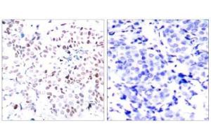 Image no. 3 for anti-Myc Proto-Oncogene protein (MYC) (pThr358) antibody (ABIN196675) (c-MYC antibody  (pThr358))