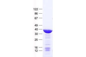 Validation with Western Blot (FOSL2 Protein (His tag))