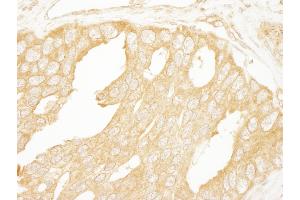 Immunohistochemistry (IHC) image for anti-B-Raf proto-oncogene, serine/threonine kinase (BRAF) (AA 25-75) antibody (ABIN7454774)