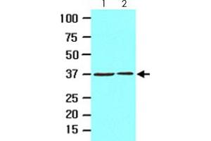 Cell lysates of HeLa (lane 1) and 293T (lane 2) (20 ug) were resolved by SDS-PAGE and probed with EPM2A monoclonal antibody, clone k2A3  (1:1000). (EPM2A antibody  (AA 243-331))