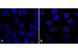 Immunocytochemistry/Immunofluorescence analysis using Mouse Anti-VPS35 Monoclonal Antibody, Clone 7E4 (ABIN6932908).