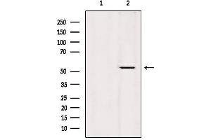 Western blot analysis of extracts from Hela, using KRT36 Antibody. (Keratin 36 antibody  (Internal Region))