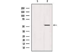 Western blot analysis of extracts from Hela, using KRT36 Antibody.