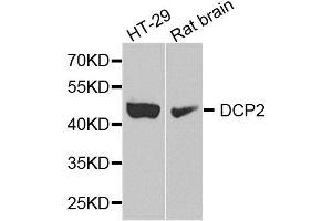 Western blot analysis of extract of HT29 and rat brain cells, using DCP2 antibody.
