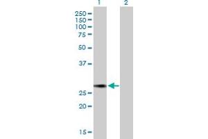 Western Blot analysis of NUSAP1 expression in transfected 293T cell line by NUSAP1 MaxPab polyclonal antibody. (NUSAP1 antibody  (AA 1-226))