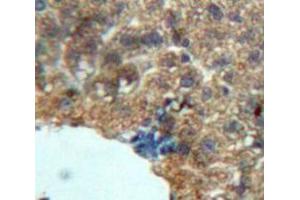 Used in DAB staining on fromalin fixed paraffin-embedded Liver tissue (Growth Hormone 1 antibody  (AA 28-216))
