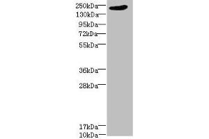 Western blot All lanes: LRP4 antibody at 1. (LRP4 antibody  (AA 1500-1725))