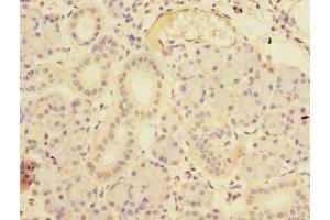 Immunohistochemistry of paraffin-embedded human pancreatic tissue using ABIN7167492 at dilution of 1:100 (RTP4 antibody  (AA 1-224))